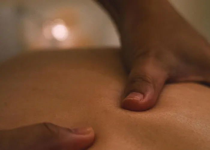 מלון Palacete Severo